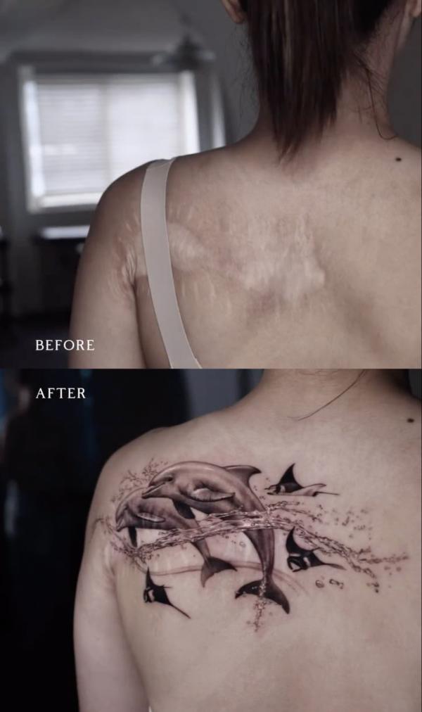 Dolphin scar cover up tattoo