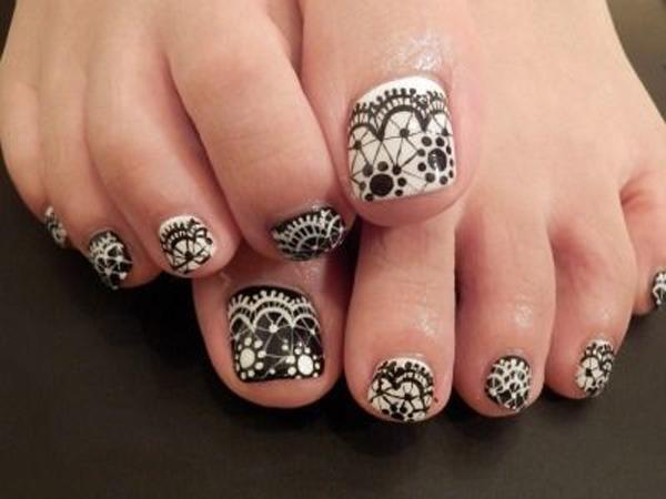 Black and white toenails