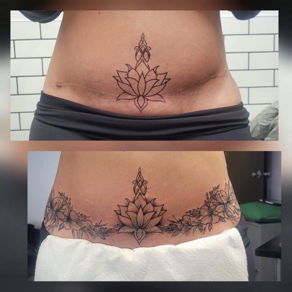 Tummy Tuck Tattoo: What You Need to Know