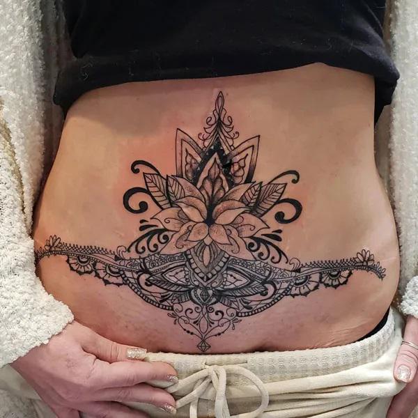 Tummy tuck scar tattoo