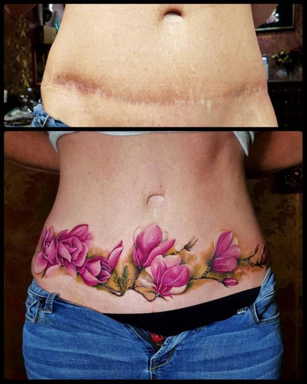magnolia tummy tuck tattoo